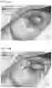 Fig. 17 - Photoelectric smoke detector having double-bulkhead darkroom structure