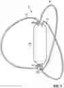 Fig. 03 - Catheter device for placing a sensor