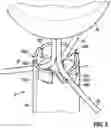 Fig. 06 - Catheter device for placing a sensor