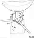 Fig. 18 - Catheter device for placing a sensor