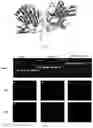 Fig. 02 - Active peptide for enhancing the phagocytic functions of retinal pigment epithelium and a use thereof