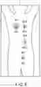 Fig. 05 - RADIOTHERAPY SYSTEM, THERAPY PLANNING SUPPORT METHOD, AND THERAPY PLANNING METHOD