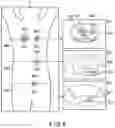 Fig. 06 - RADIOTHERAPY SYSTEM, THERAPY PLANNING SUPPORT METHOD, AND THERAPY PLANNING METHOD