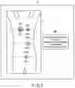 Fig. 08 - RADIOTHERAPY SYSTEM, THERAPY PLANNING SUPPORT METHOD, AND THERAPY PLANNING METHOD