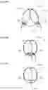 Fig. 12 - Light-blocking member and light-blocking structure