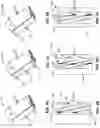 Fig. 09 - Flow control systems having movable slotted plates