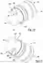 Fig. 12 - Compressor having suction fitting