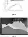 Fig. 02 - Hearing enhancement and protection device