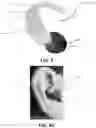 Fig. 07 - Hearing enhancement and protection device