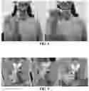 Fig. 06 - FUNCTIONAL TOOTHBRUSH STICK AND METHOD FOR MANUFACTURING SAME