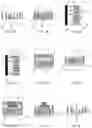 Fig. 04 - Method for producing a toothbrush head or a part thereof