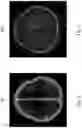 Fig. 06 - System and method for analyzing brain tissue components based on magnetic resonance image