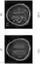 Fig. 07 - System and method for analyzing brain tissue components based on magnetic resonance image
