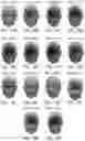 Fig. 18 - SYSTEMS AND METHODS FOR MEASURING NEUROLOGIC FUNCTION VIA ODORANT, AUDIBLE AND/OR SOMATOSENSORY STIMULATION
