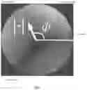 Fig. 02 - Device and method for spatiotemporal reconstruction of a moving vascular pulse wave in the brain and other organs