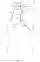 Fig. 02 - TRANSCAROTID VASCULAR ACCESS SHEATH