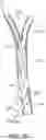 Fig. 09 - TRANSCAROTID VASCULAR ACCESS SHEATH