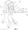 Fig. 02 - Retractable cannula assembly
