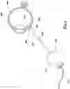 Fig. 06 - Retractable cannula assembly