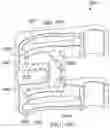 Fig. 74 - Dynamization tabs providing component interconnectivity for external fixation devices