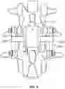 Fig. 06 - Spine protection device