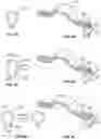Fig. 07 - Spine protection device