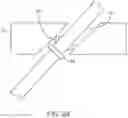 Fig. 22 - Implant and method for long bone fixation