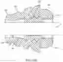Fig. 35 - Implant and method for long bone fixation