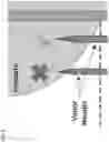 Fig. 15 - Medical devices and methods