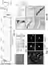 Fig. 04 - ATLAS OF CHOROID PLEXUS CELL TYPES AND THERAPEUTIC AND DIAGNOSTIC USES THEREOF