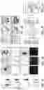 Fig. 06 - ATLAS OF CHOROID PLEXUS CELL TYPES AND THERAPEUTIC AND DIAGNOSTIC USES THEREOF