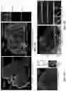Fig. 12 - ATLAS OF CHOROID PLEXUS CELL TYPES AND THERAPEUTIC AND DIAGNOSTIC USES THEREOF