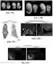 Fig. 52 - ATLAS OF CHOROID PLEXUS CELL TYPES AND THERAPEUTIC AND DIAGNOSTIC USES THEREOF