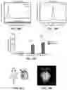 Fig. 53 - ATLAS OF CHOROID PLEXUS CELL TYPES AND THERAPEUTIC AND DIAGNOSTIC USES THEREOF