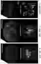 Fig. 54 - ATLAS OF CHOROID PLEXUS CELL TYPES AND THERAPEUTIC AND DIAGNOSTIC USES THEREOF