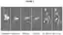Fig. 02 - Labeled fluorocarbon agents for positron emission tomography imaging