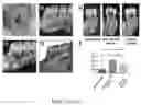 Fig. 12 - DENTAL ADHESIVE HYDROGELS AND USES THEREOF