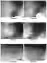 Fig. 09 - INJECTABLE SHEAR-THINNING HYDROGELS AND USES THEREOF