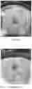 Fig. 16 - INJECTABLE SHEAR-THINNING HYDROGELS AND USES THEREOF