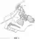 Fig. 02 - BALLOON IRRIGATION AND CLEANING SYSTEM FOR INTERIOR WALLS OF SINUS CAVITIES