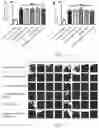 Fig. 03 - Emodin succinyl ester compound, preparation method therefor and application thereof