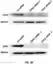 Fig. 06 - Sulfonylamide compounds as CDK2 inhibitors