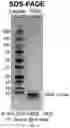 Fig. 14 - Deoxynucleic Guanidines (DNG)- Modified Oligonucleotides and Methods of Synthesizing Deoxynucleic Guanidine Strands