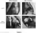 Fig. 12 - Compositions and methods for inhibiting CD279 interactions