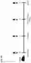 Fig. 103 - Recombinant adenoviruses and uses thereof