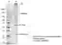 Fig. 01 - Variant AIM