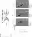 Fig. 31 - NK CELL-DIRECTED CHIMERIC PROTEINS