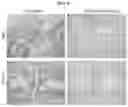 Fig. 09 - METHODS OF USE OF SOLUBLE CD24 FOR THERAPY OF RHEUMATOID ARTHRITIS