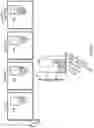 Fig. 15 - METHODS OF TREATING CANCER USING PD-1 AXIS BINDING ANTAGONISTS AND TIGIT INHIBITORS