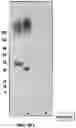 Fig. 45 - Antibodies against OX-40 and uses thereof